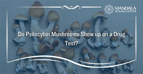 Does Psilocybin Show Up on a Drug Test: Unraveling the Mysteries of Psychedelic Detection